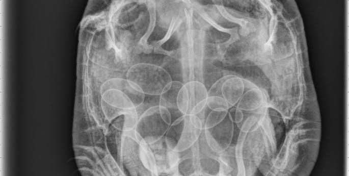 A happy ending for eastern long-necked turtle